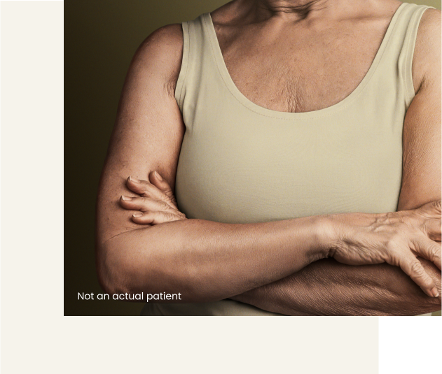 Real life image of an older woman's crossed arms